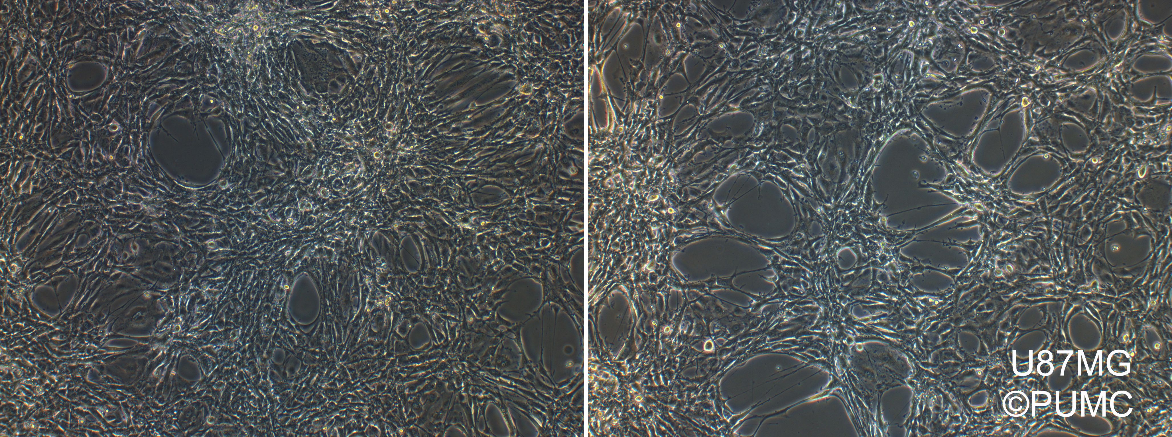 ATCC CCL-228 U-87 MG细胞图片